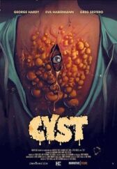 Киста онлайн бесплатно Cinema Stream